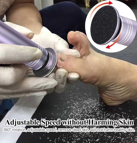 Adjustable Speed Electric Callus Remover for Feet - 1200 RPM