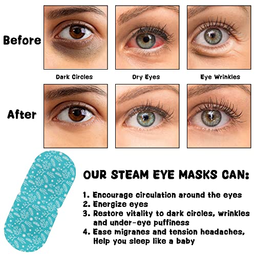 HOMEFOX Disposable Steam Eye Mask for Dry Eye Care - 8 Pack Heating Eye Mask for Dark Circles and Puffiness Relief Soothing Warm Eyes Masks Pads, Fragrance Free