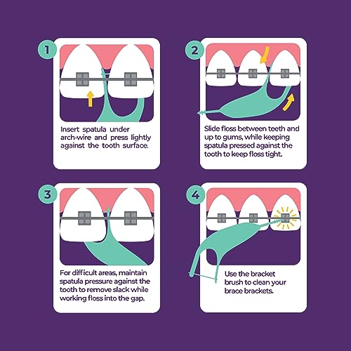 Platypus Orthodontic Flossers for Braces, 40 Count