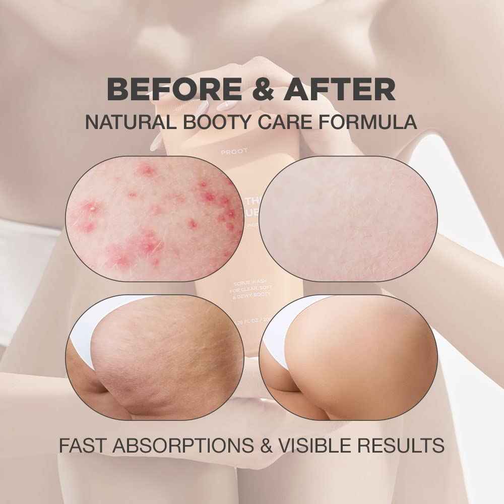 Butt Scrub Wash and Butt Acne & Ingrown Hair Treatment Serum | AHA & BHA Butt Acne and Ingrown Hair Treatment For Bikini Area | Get rid of Butt Acne, Ingrown Hair, Back Acne, Strawberry Legs