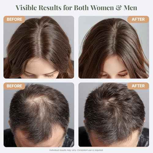 The ?LIX USDA Organic Rosemary Oil for Hair Growth | Thickening Formula with Castor & Pumpkin Seed | for Hair Loss & Thinning | Made in USA | 4oz