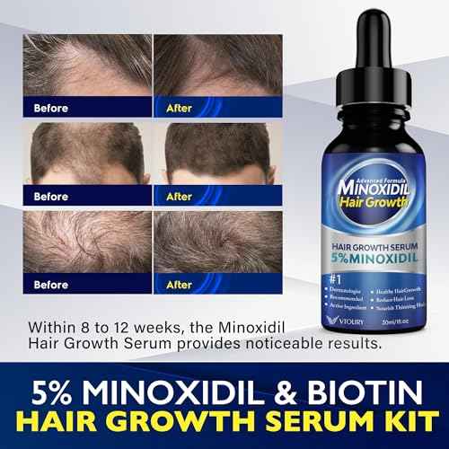 2-Pack Minoxidil for Men and Women Hair Growth- Monoxide for Women Hair Growth, Monoxide for Men Hair, Beard Growth Oil