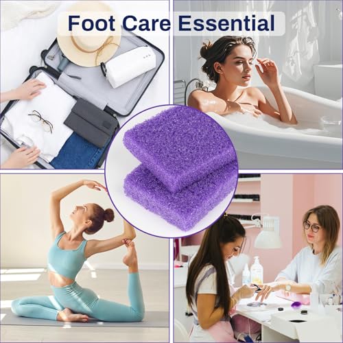 20 Pack Small Pumice Stones for Feet - Exfoliating Foot Callus Remover