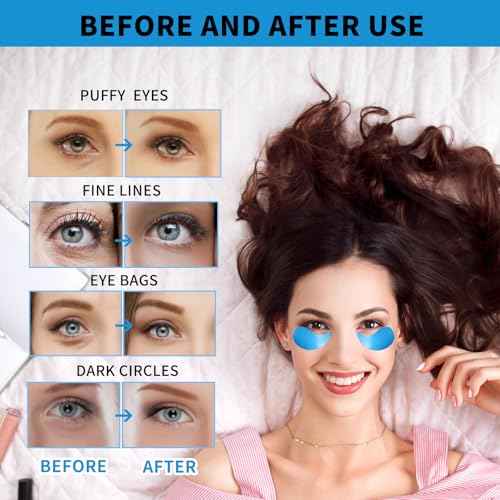 Under Eye Masks for Dark Circles and Puffiness 70PCS, Under Eye Patches for Puffy Eyes Treatment, Under Eye Gel Pads w/Collagen, Retinol, Hyaluronic Acid for Eye Bags Treatment, Gel Eye Mask Skincare