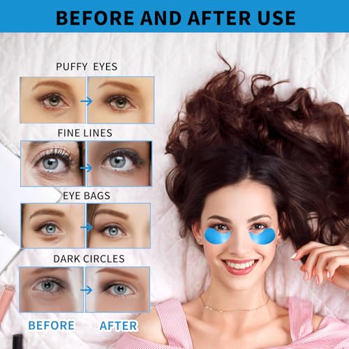 Under Eye Masks for Dark Circles and Puffiness 70PCS, Under Eye Patches for Puffy Eyes Treatment, Under Eye Gel Pads w/Collagen, Retinol, Hyaluronic Acid for Eye Bags Treatment, Gel Eye Mask Skincare