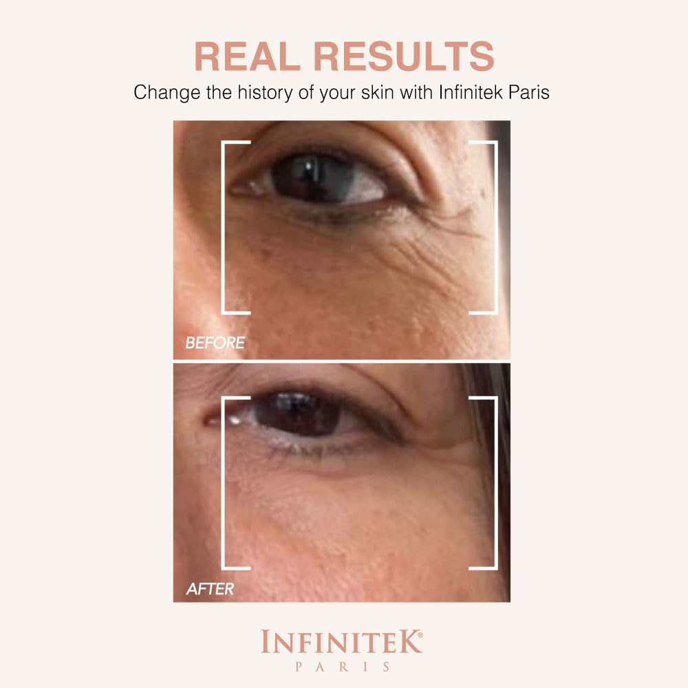 Infinitek Paris Multi-Active Collagen Eye Cream & Retinol Serum Eye Contour - Anti Aging Eye Cream for Wrinkles, Under Eye Treatment for Dark Circles and Under Eye Wrinckle Repair. 0.50 Fl Oz