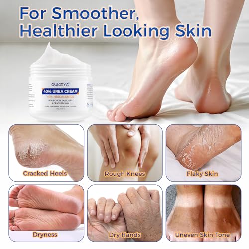 OUKEYA 40% Urea + 3% Niacinamide Foot Cream 5.29 oz, for Dry Calloused Heels