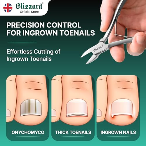 Ingrown Nail Clippers for Men with Ingrown Toenails ? Blizzard Podiatrist Toenail Clipper Set German Forged (13cm - Straight Head - Smooth)
