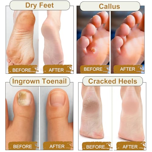 10-Pack Epsom Salt Foot Soak for Tired Feet with Essential Oils