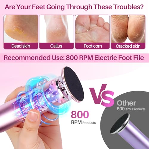 LIONVISON Electric Foot Callus Remover - Adjustable Pedicure Tool with 60 Discs