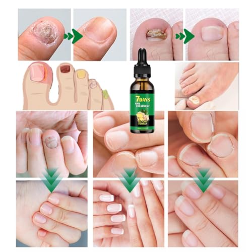 IMOLL Ginger Nail Growth Serum & Cuticle Oil - Nail Care Treatment (2 Pack)