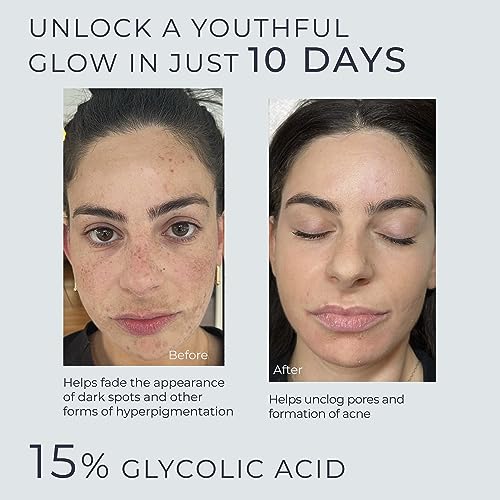 Glycolic Acid Serum for Face 15% Strength - Extra Large Size (2Oz) - Advanced Formula for Enhancing Skin Radiance, Texture Improvement, Addressing Uneven Tone & Fine Lines by InstaSkincare