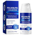 Salicylic Acid Acne & Folliculitis Cream 100g