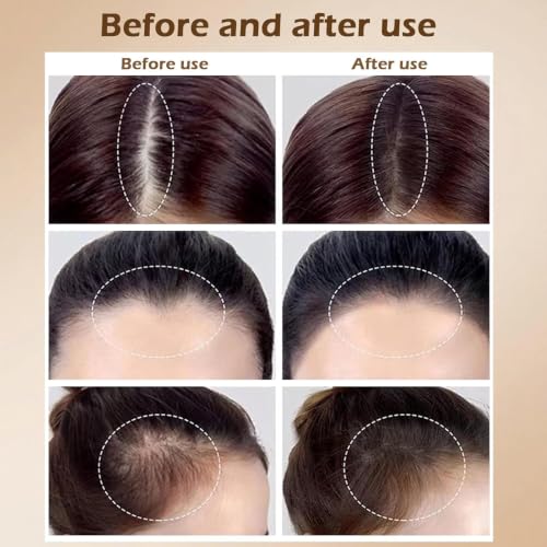 Densiq Pro Hair Density Filler Powder - Waterproof Hairline