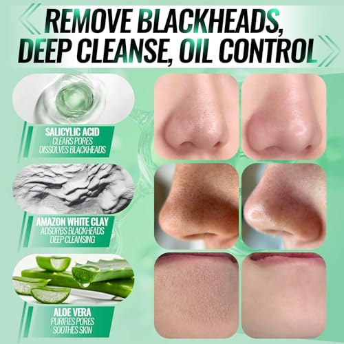 SYABO 2.0 Blackhead Remover Mask with Salicylic Acid | 100 Strips