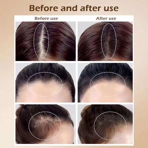 Invisible Hairline Powder - Natural Look Hair Fibers for Thinning Hair - Black, Large Pack of 1