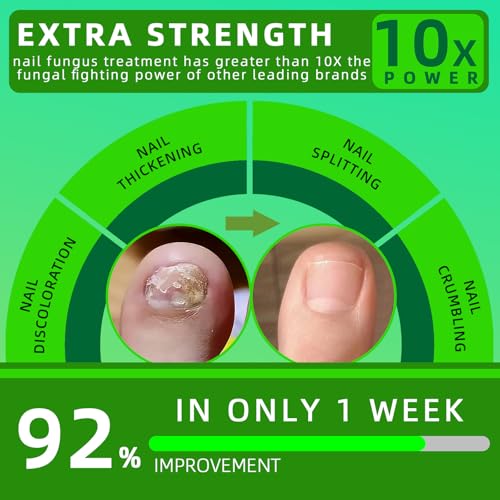 NoxyRal Extra Strength Toenail Fungus Treatment Brush-On with Botanical Oils, 1 fl oz