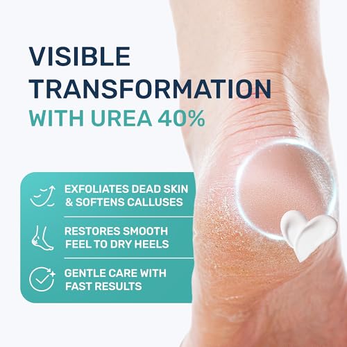Urea Cream 40% for Feet - Maximum Strength Callus Remover