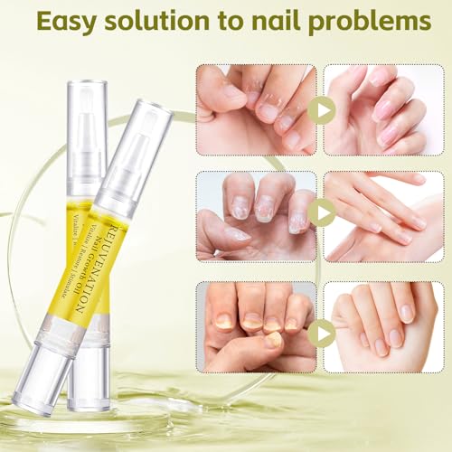 Rejuvenation Nail Growth Oil & Cuticle Care Pens with File (4 Pack)