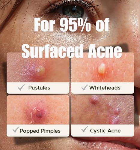 Hydrocolloid Acne Patches with Salicylic Acid - 108 Pimple Stickers