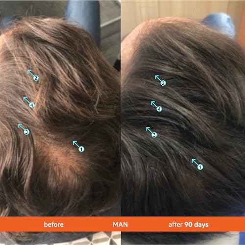 DS Labs Revita Conditioner Refill Pouch, 500 mL ? Scalp Refreshing Hydration for Fuller Looking, Weightless Hydration, Caffeine, Turmeric, Sulfate & Silicone Free, Color Safe, For Men & Women