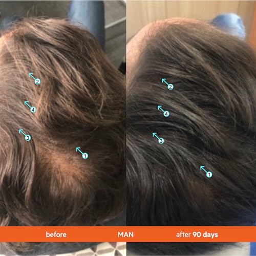 Revita Hair Density Conditioner for Fine & Thinning Hair 205ml