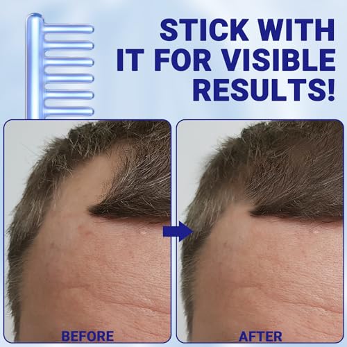 Spare Glass Attachment for Facial Wand