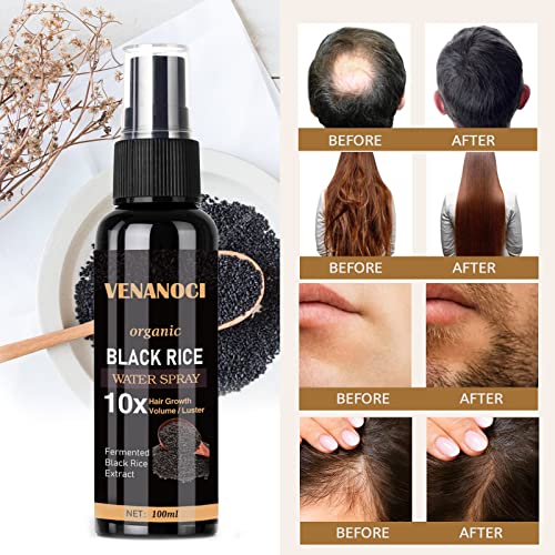 Venanoci Hair Growth Serum, Rice Water Spray for Women & Men Treatment For Hair Loss, Damaged Dry Hair, Hair Regrowth for Thicker Longer Fuller Hair with Castor oil Ginger