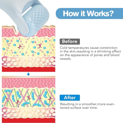Fronnor Ice Roller for Face & Eyes | Cooling Facial Massager