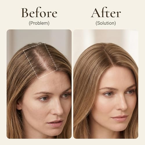LUVITA Hair Growth Serum for Thinning Hair - 2fl oz