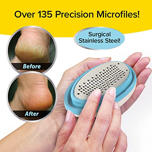 PedEgg Classic Foot File & Callus Remover - Mess-Free Exfoliating Tool