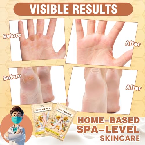 TEAWOO 18 Pairs Moisturizing Hand & Foot Masks for Cracked Heels