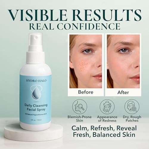 0.02% Hypochlorous Acid Spray for Face & Skin ? Hydrating Facial Mist, Calm Redness & Irritation, Post-Workout, pH Balanced, No Alcohol, Daily Skin Care, Made in USA, 4 Oz