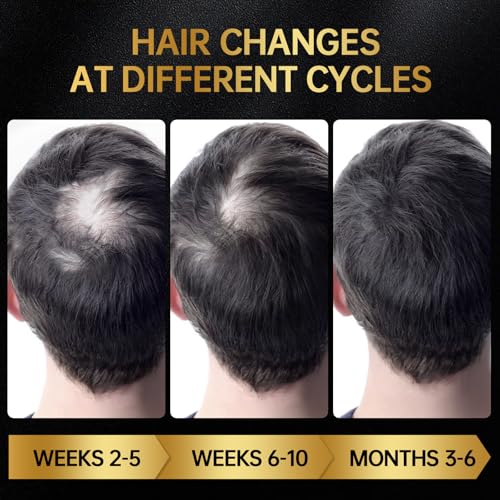 Minoxidil 5% Hair Regrowth Serum for Men & Women, 60ml