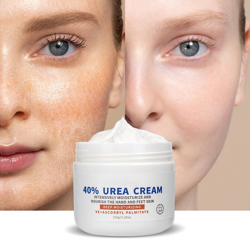 Grospe 40% Urea Foot Cream for Cracked Heels & Dry Skin Repair 5.29 Oz