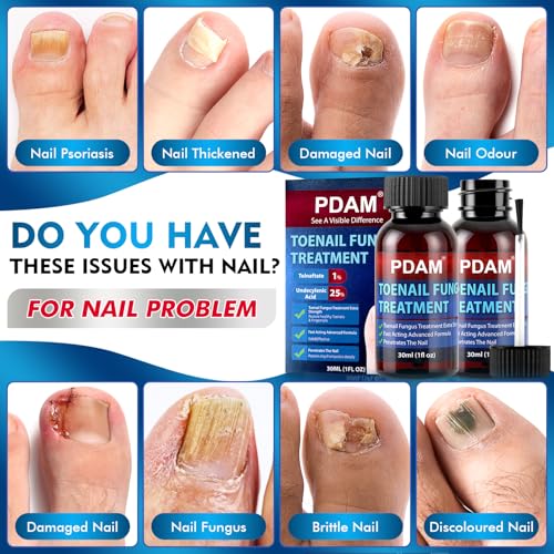 Toenail Care Solution with 25% Undecylenic Acid - 2 Pack