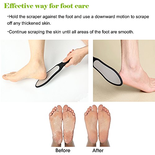 BEZOX Double-Sided Stainless Steel Foot File & Callus Remover Rasp