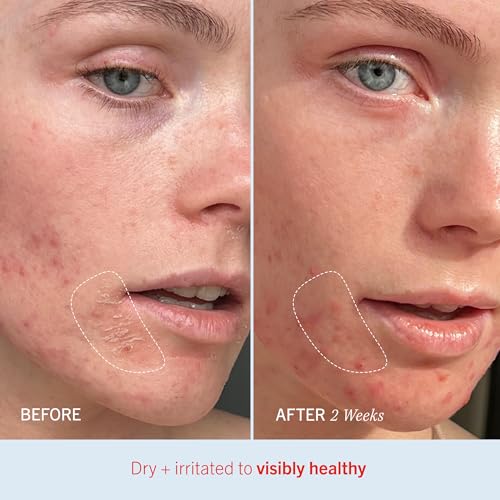 First Aid Beauty - Ultra Repair Cream, Intense Hydration Whipped Colloidal Oatmeal, Strengthens Skin Barrier in 7 Days & Helps Relieve Eczema, Luxury Face & Body Moisturizer, Grapefruit Scent, 12 oz