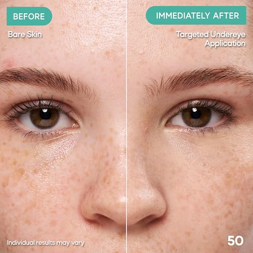 Almay Clear Complexion Concealer - Acne-Prone Skin, Shade 200