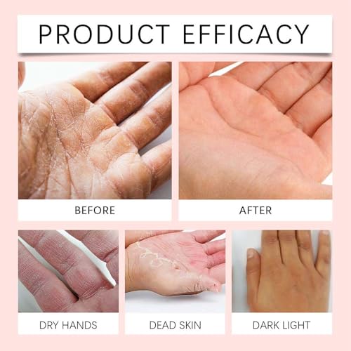 Retinol Hand Cream for Anti-Aging & Moisturizing Care - 50g