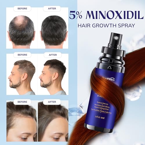 5% Minoxidil Hair Growth Serum for Men & Women - 2-Pack