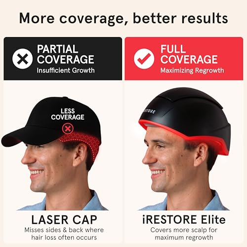 iRestore Elite Laser Hair Growth Cap - 500 Lasers & LEDs