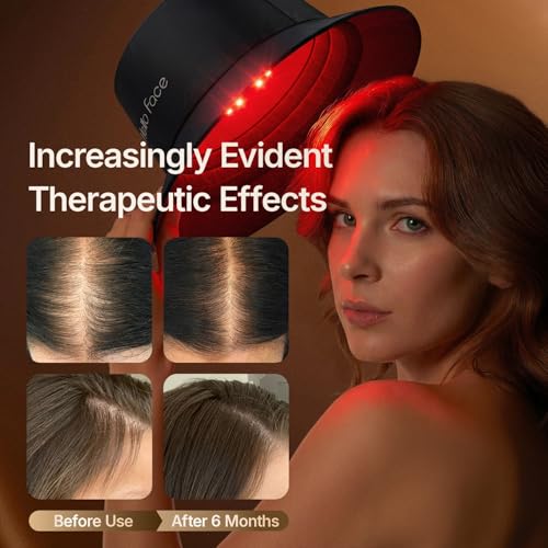 Red Light Therapy Hair Growth Cap - 660nm & 850nm LED
