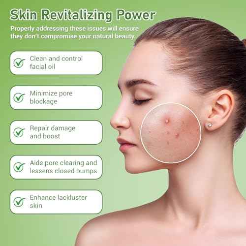 14% Azelaic Acid Acne Cream, Azelaic Acid For Face, Helps Improve the Appearance of Acnes - Azalecic Acids Acido Azelaico, 1 Fl Oz