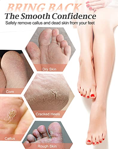 Maryton 2pcs Natural Lava Pumice Stones for Feet & Hands Callus Removal