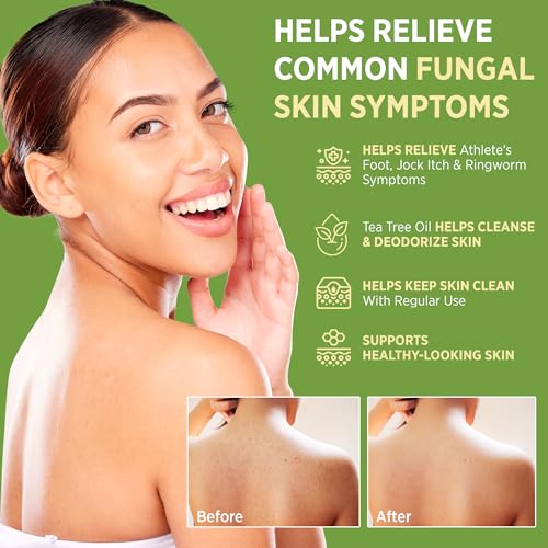Roycederm Antifungal Bar Soap - Tea tree Oil Soap - Athlete¡¯s Foot Treatment for Jock Itch & Ringworm - Medicated Antifungal Soap with Clotrimazole 1% - Tea Tree Oil Scent, 2 Pack