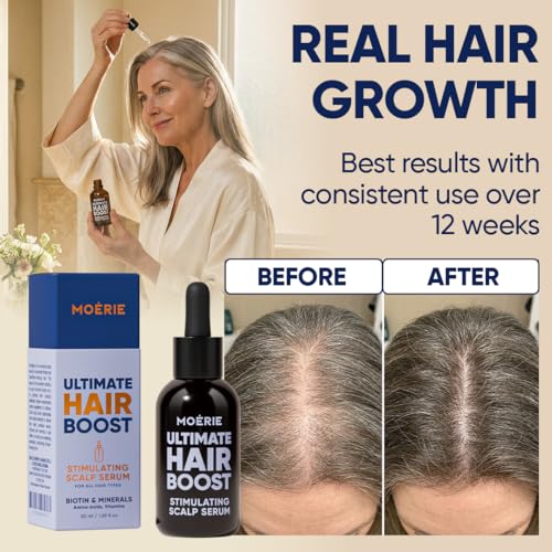 Moerie Hair Growth Serum - Natural Regrowth & Thickening, 50ml
