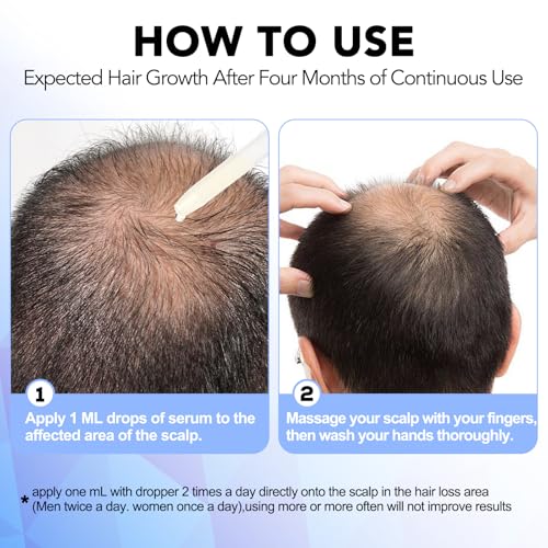 5% Minoxidil Hair Regrowth Serum with Dropper