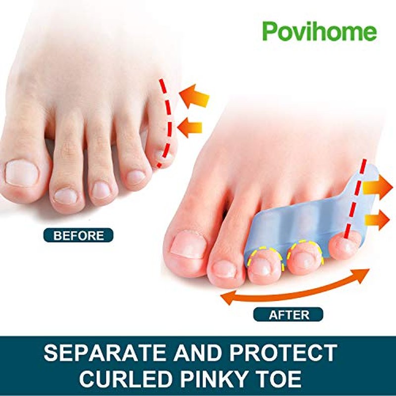 Povihome Pinky Toe Separators - 10 Pack for Pain Relief