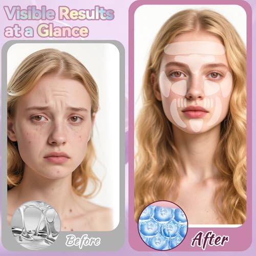 Facial Wrinkle Patches, 256 Pcs Overnight Silicone Forehead Wrinkle Patches, Anti-Aging Face Patches Remover to Fine Lines, Mouth, Frown Lines (Pink)